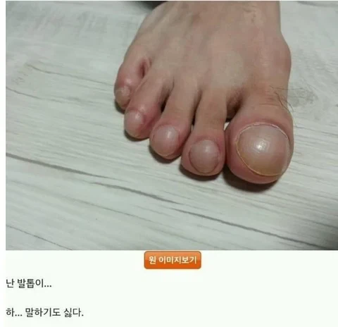 엄지발톱 인증 레전드 · 1번째 이미지