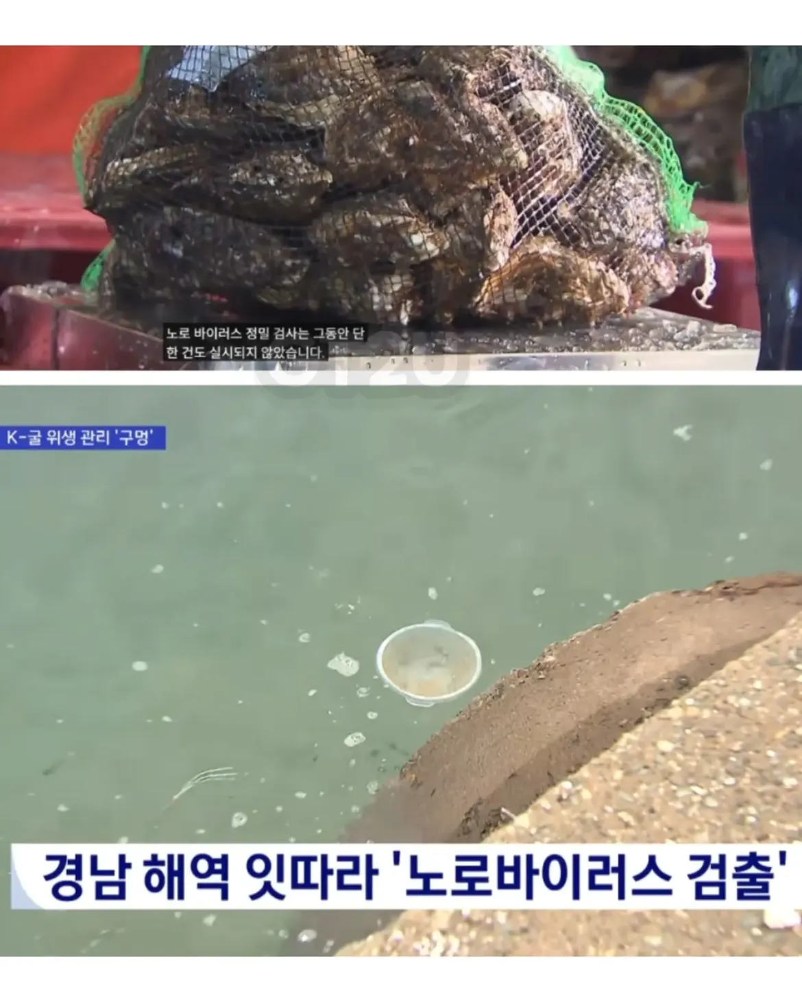 국산 마운자로 근황.jpg · 2번째 이미지