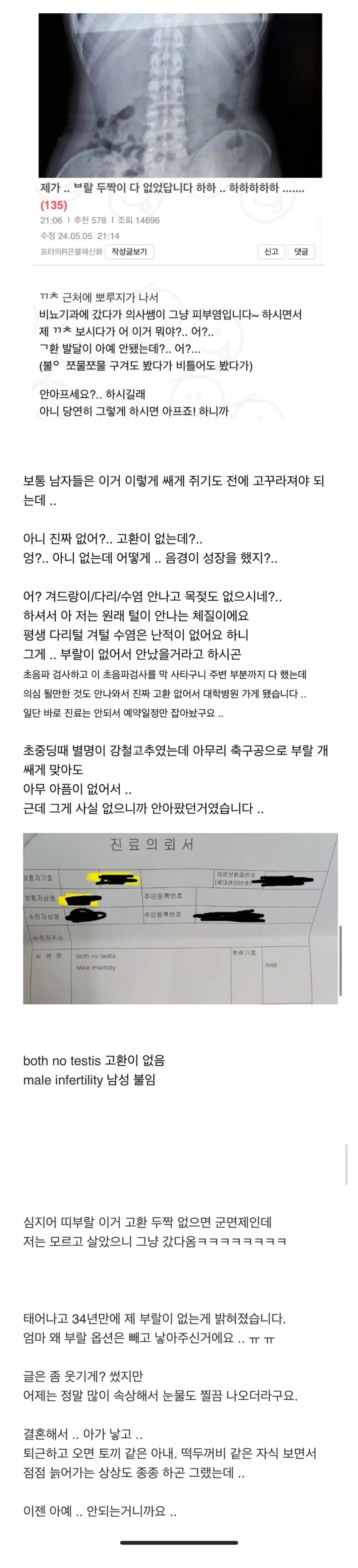 제가 부랄 두짝이 다 없었답니다..jpg