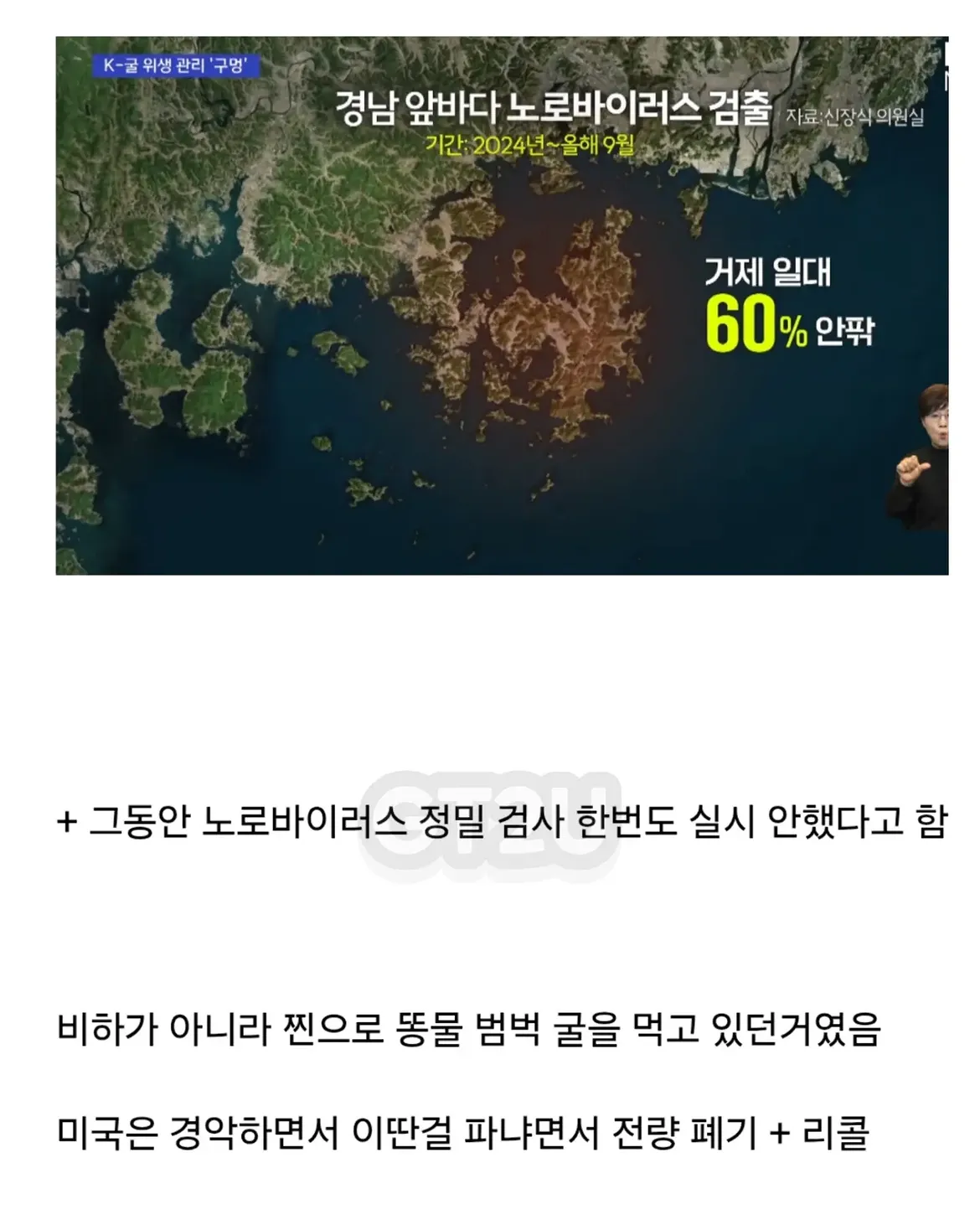 국산 마운자로 근황.jpg · 3번째 이미지