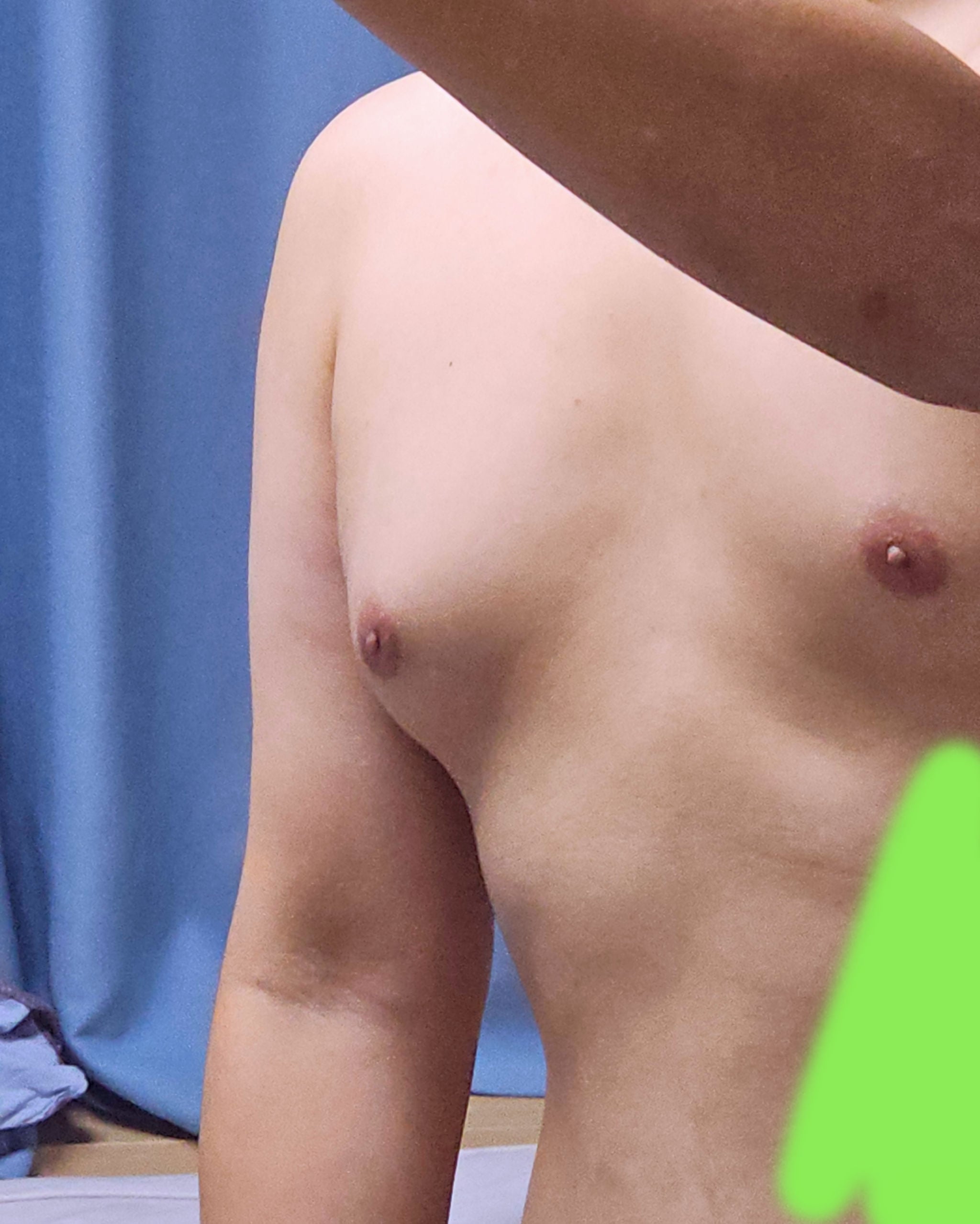 (극혐주의) 개붕이 여유증 이거 심각한편이냐???