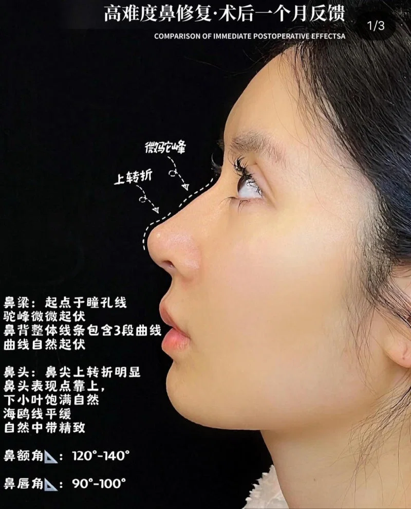 요즘 성형 트렌드 · 2번째 이미지
