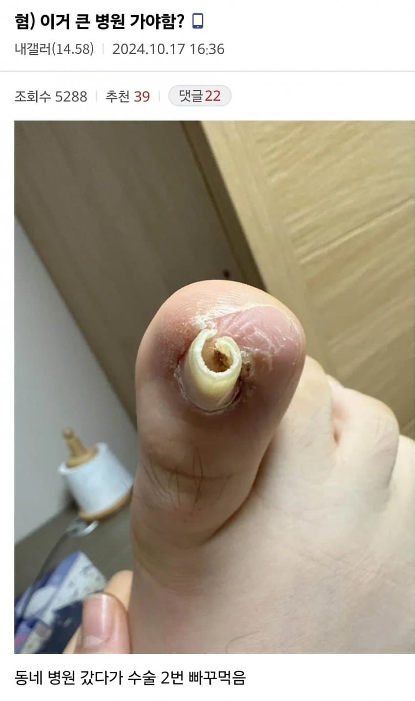 백종원이 좋아하는 발톱 모양 · 1번째 이미지