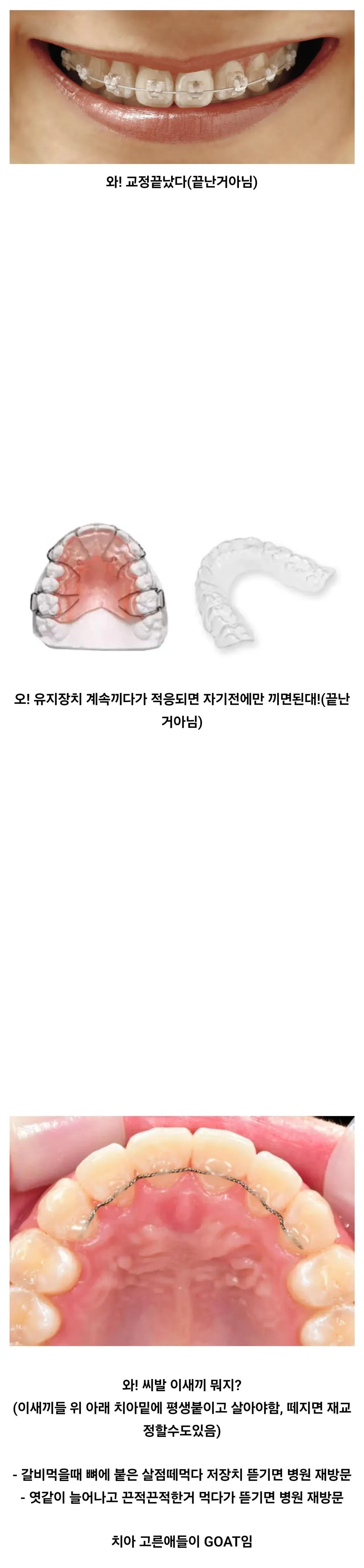 치아 가지런한게 큰 축복인 이유..jpg · 1번째 이미지