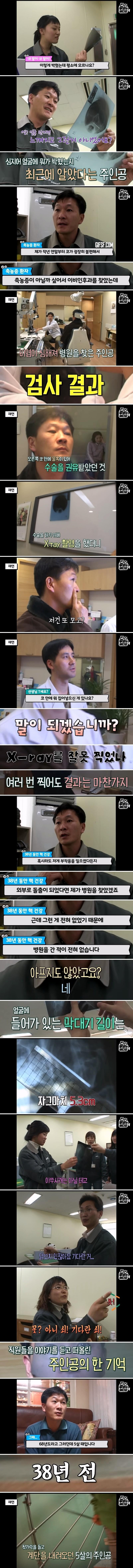 축농증 수술하러 갔다가 발견한 물건의 정체 · 2번째 이미지