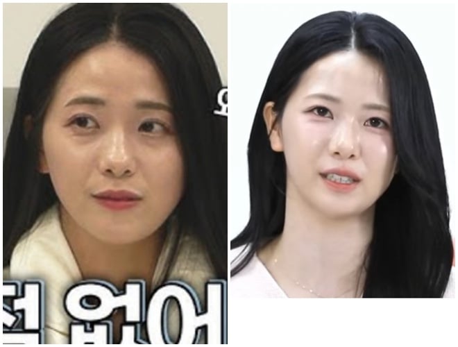 얼굴비대칭이 의미가 없는이유 · 2번째 이미지