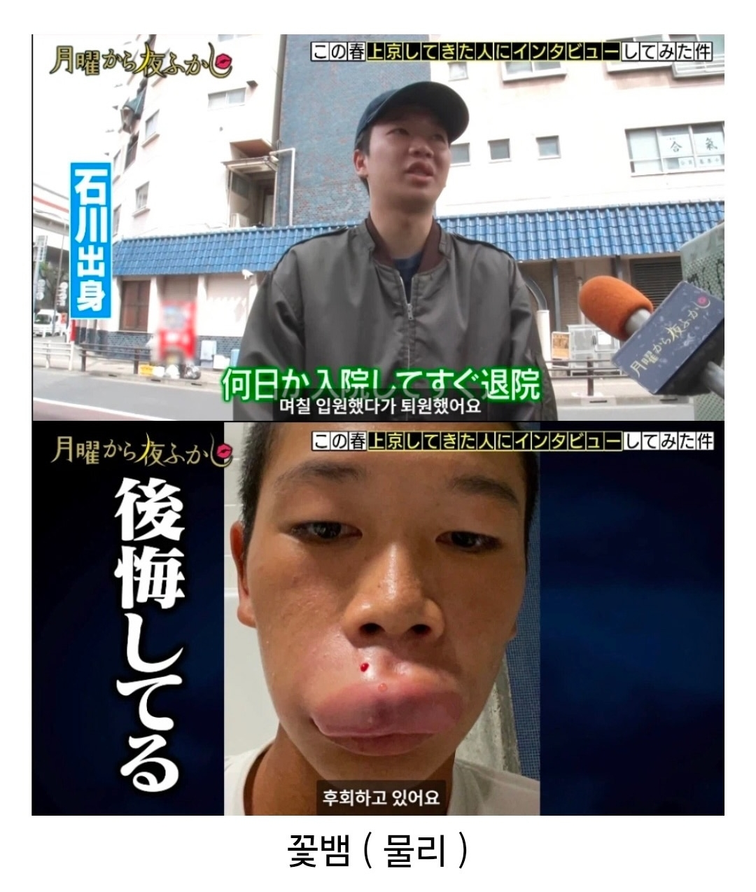 도쿄에 오자마자 꽃뱀에게 물린 시골 청년.jpg · 4번째 이미지