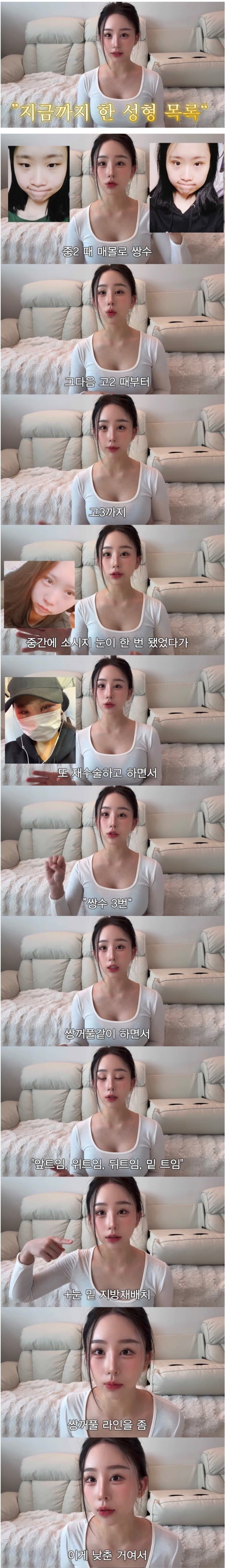 중2때부터 했던 성형 다 밝힌 유튜버 · 3번째 이미지