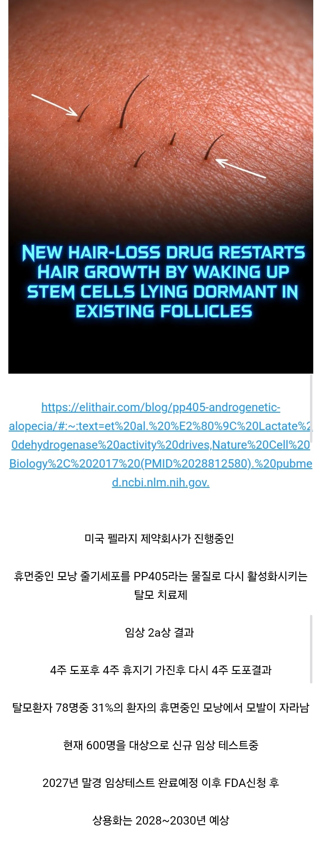 탈모 신약치료제가 뻥카인지 아닌지 ceo를 보면 알수있다..jpg · 1번째 이미지