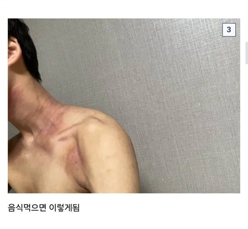 쌀 알레르기 있는데 군대 가는 썰 · 4번째 이미지
