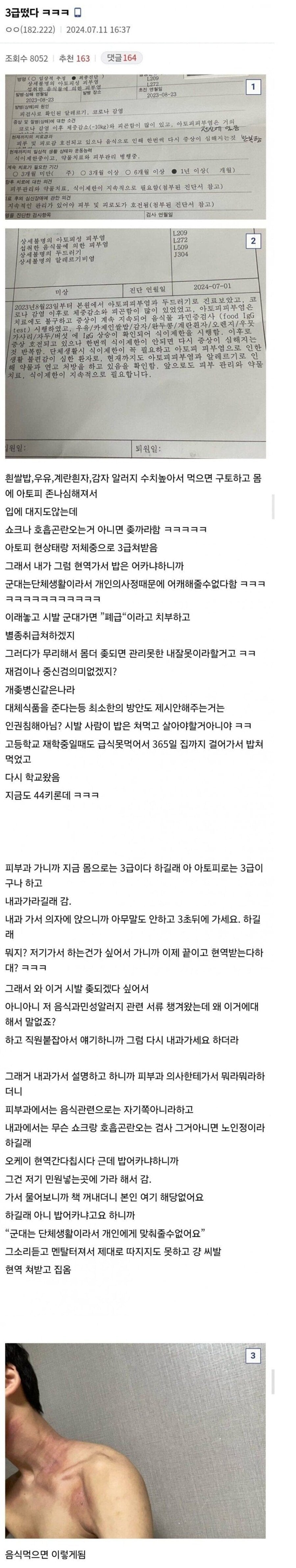 쌀 알레르기가 있는데 군대가는 썰 · 1번째 이미지