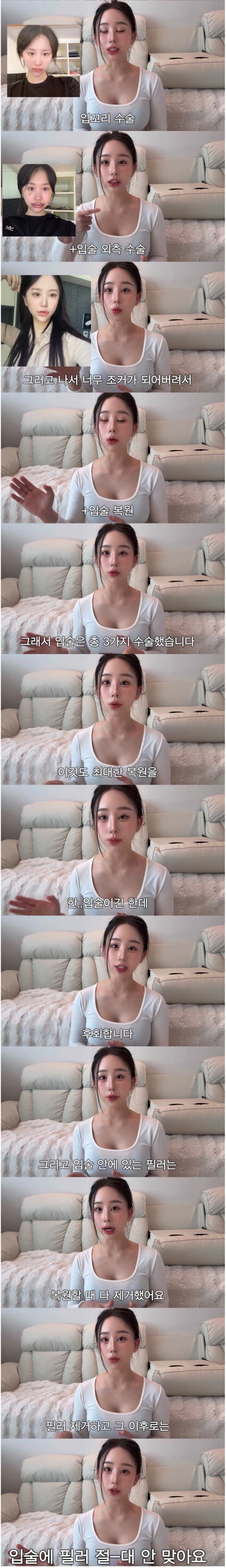 중2때부터 했던 성형 다 밝힌 유튜버 · 1번째 이미지