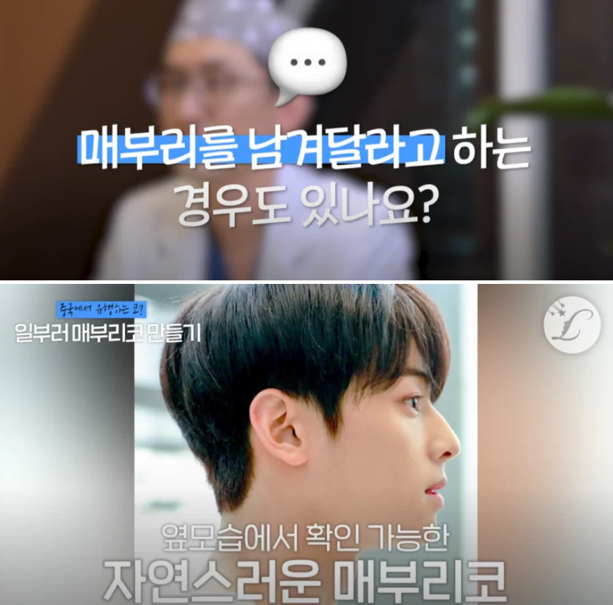 요즘 성형 트렌드 · 3번째 이미지